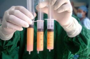 抽脂后應(yīng)穿醫(yī)用彈力襪