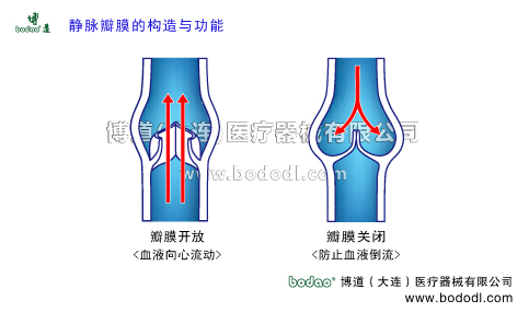 深靜脈血栓形成的預(yù)防與護(hù)理