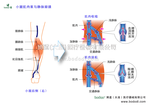 深靜脈血栓形成的預(yù)防與護(hù)理