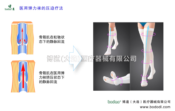 深靜脈血栓形成的預(yù)防與護(hù)理