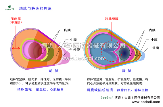 靜脈曲張的預防與治療