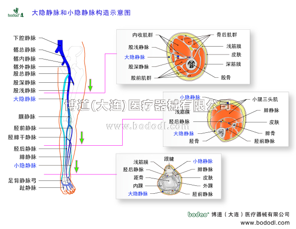 靜脈曲張的預(yù)防與治療