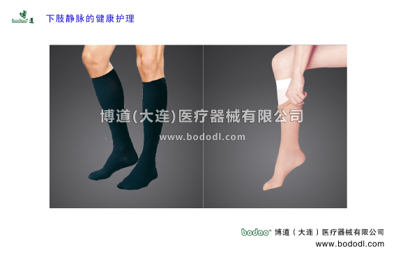 靜脈曲張的預(yù)防與治療