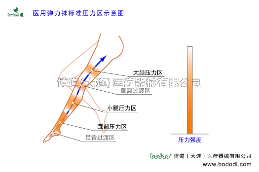 靜脈曲張的預(yù)防與治療