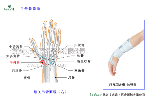 腕關節(jié)的常見疾病與健康防護