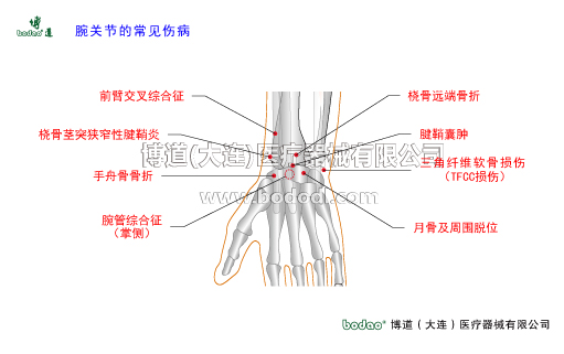 腕關節(jié)的常見疾病與健康防護