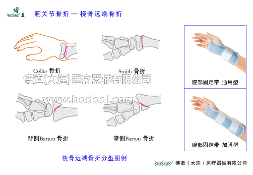 腕關節(jié)的常見疾病與健康防護