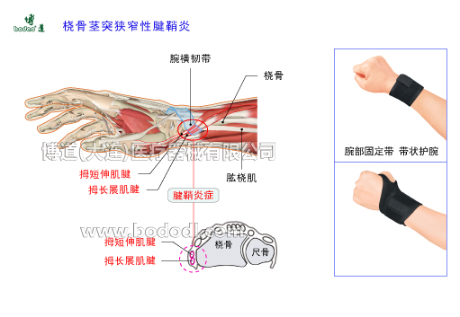 腕關節(jié)的常見疾病與健康防護