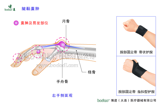 腕關節(jié)的常見疾病與健康防護