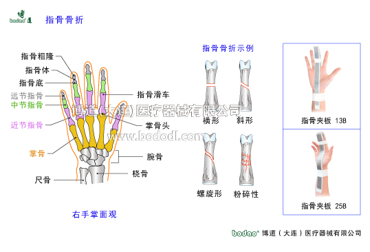手關(guān)節(jié)常見傷病與健康防護(hù)