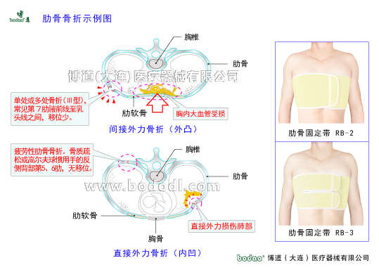 胸肋部常見疾病與健康護(hù)理