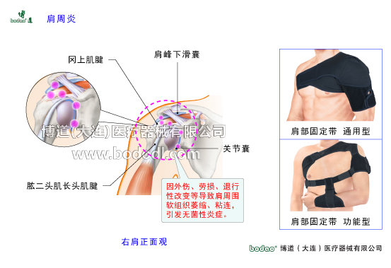 肩關節(jié)的常見疾病與健康防護
