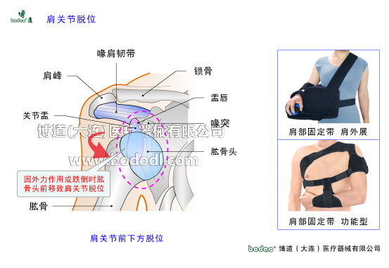 肩關節(jié)的常見疾病與健康防護