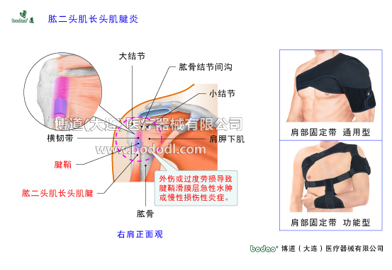 肩關(guān)節(jié)的常見疾病與健康防護