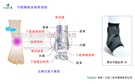 踝關節(jié)的構造與常見傷病