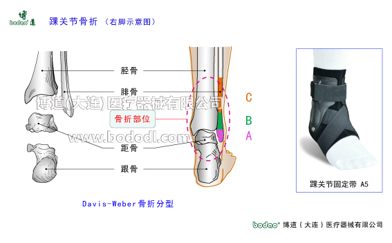 踝關節(jié)的構造與常見傷病