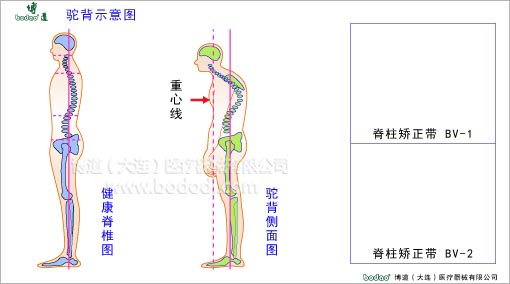 脊椎部疾病與健康護理