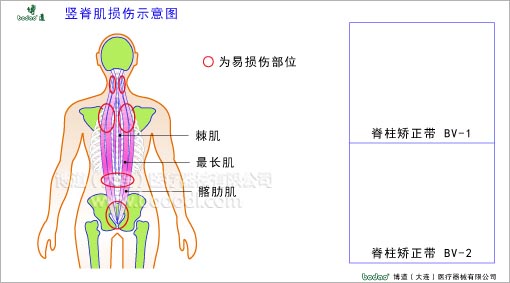 脊椎部疾病與健康護理