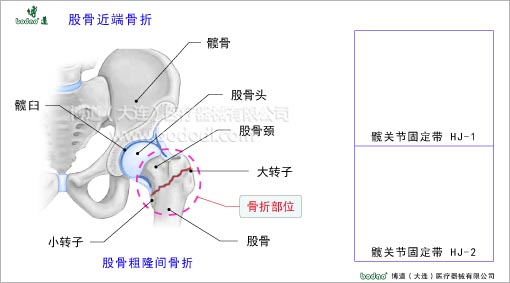 髖關(guān)節(jié)疾病與健康護理