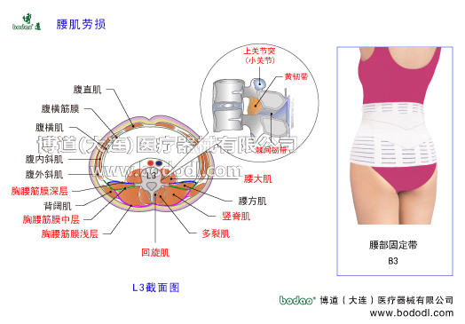 腰肌勞損慢性腰痛腰背肌筋膜炎功能性腰痛腰部軟組織損傷慢性腰痛的主要癥狀與治療博道腰部固定帶日本透氣性醫(yī)用護(hù)腰骶部軟組織慢性損傷豎脊肌腰大肌多裂肌腰背筋膜深層中層淺層腰扭傷腰椎部肌肉結(jié)構(gòu)解剖腰方肌豎脊肌橫突間肌回旋肌腹外斜肌腹內(nèi)斜肌腹橫肌背闊肌胸腰筋膜的功能腰椎骨質(zhì)增生腰椎間盤突出腰椎壓縮性骨折腰椎小關(guān)節(jié)紊亂腰骶關(guān)節(jié)勞損骶髂關(guān)節(jié)炎腰椎固定帶護(hù)腰帶腰圍腰托腰椎固定矯正牽引支具腰椎固定支具腰痛帶博道護(hù)腰透