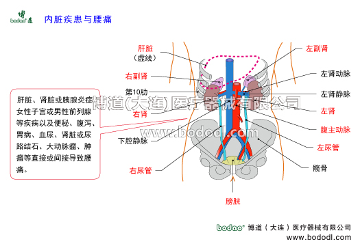 內(nèi)臟疾患與腰痛。腰椎病及腰痛的三大發(fā)病原因，腰痛的主要原因。腰痛與內(nèi)臟疾患相關(guān)。腰椎病的預(yù)防與治療，博道醫(yī)用腰部固定帶透氣性護(hù)腰的功能與作用。腰椎病的治療與防護(hù)。肝臟腎臟胰腺炎癥女性子宮或男性前列腺等疾病及便秘腹瀉胃病血尿腎臟或尿路結(jié)石大動脈瘤腫瘤等引發(fā)腰痛。腰部關(guān)節(jié)疾病如腰椎關(guān)節(jié)腰骶關(guān)節(jié)骶髂關(guān)節(jié)髖關(guān)節(jié)以及腰腹部肌肉筋膜肌腱神經(jīng)等軟組織損傷或病變導(dǎo)致腰痛。腰痛其它因素：婦科疾病痛經(jīng)孕期產(chǎn)后更年期體寒