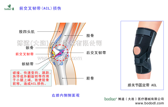 膝關(guān)節(jié)前交叉韌帶ACL損傷的原因、癥狀及治療方法。博道膝關(guān)節(jié)醫(yī)用固定帶膝關(guān)節(jié)ACL前交叉韌帶損傷斷裂的治療與護理可調(diào)節(jié)式膝關(guān)節(jié)前交叉韌帶固定夾板膝關(guān)節(jié)軟組織損傷固定矯正支架膝關(guān)節(jié)骨質(zhì)增生膝關(guān)節(jié)外傷等防護與術(shù)后固定護膝博道加壓護膝前十字ACL韌帶損傷固定帶膝關(guān)節(jié)ACL前交叉韌帶前十字韌帶損傷防護固定膝關(guān)節(jié)的構(gòu)造ACL前交叉韌帶前十字韌帶重建康復(fù)固定膝關(guān)節(jié)疾病的預(yù)防與治療膝關(guān)節(jié)疾病的治療與康復(fù)護理博道加