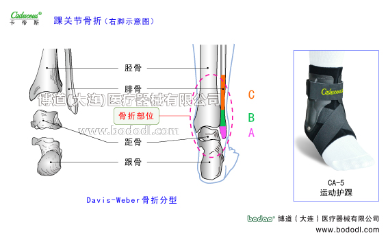 踝關(guān)節(jié)的運(yùn)動(dòng)損傷與防護(hù)