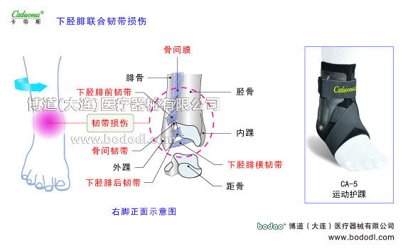 踝關(guān)節(jié)的運動損傷與防護