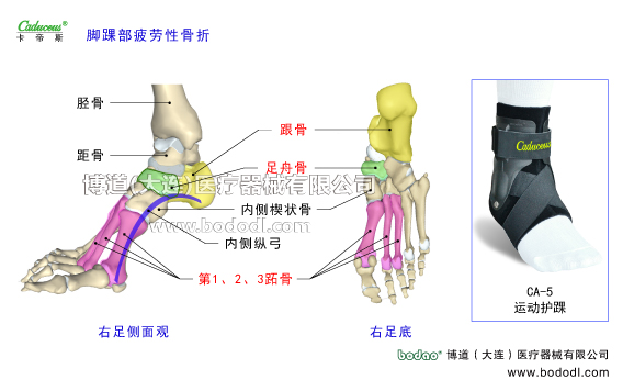 踝關(guān)節(jié)的運(yùn)動(dòng)損傷與防護(hù)