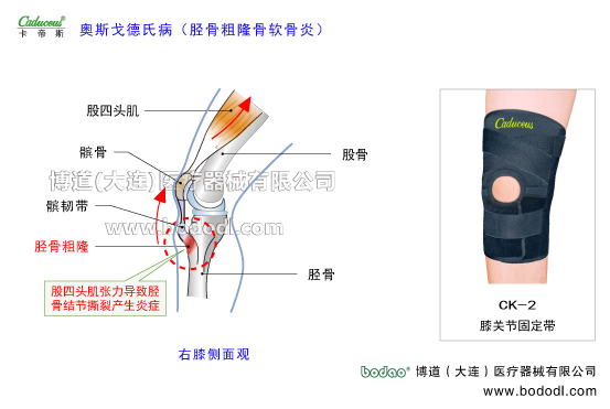 膝關(guān)節(jié)的運(yùn)動(dòng)損傷與防護(hù)