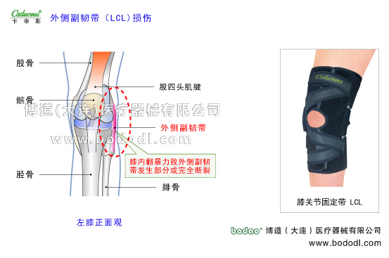 膝關(guān)節(jié)的運(yùn)動(dòng)損傷與防護(hù)