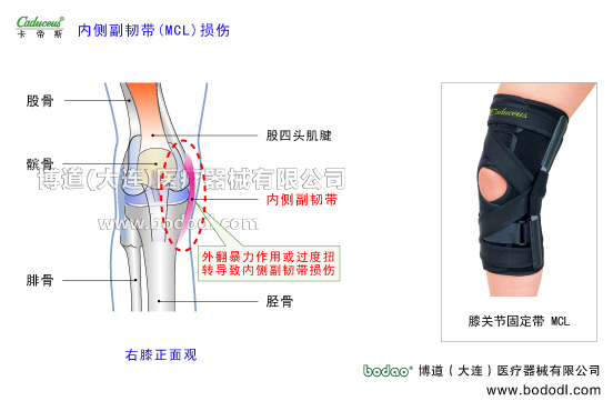 膝關(guān)節(jié)的運(yùn)動(dòng)損傷與防護(hù)