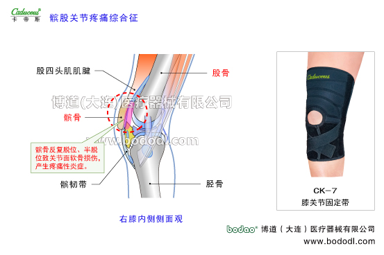 膝關(guān)節(jié)的運(yùn)動(dòng)損傷與防護(hù)