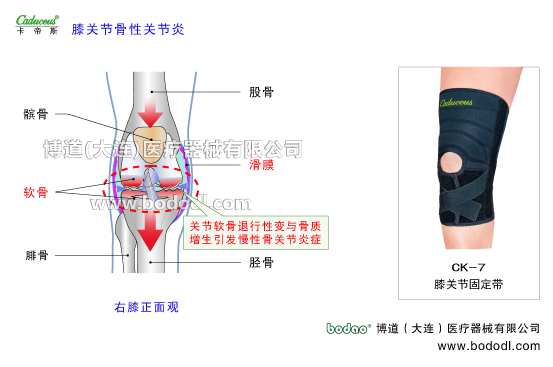 膝關(guān)節(jié)的運(yùn)動(dòng)損傷與防護(hù)