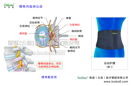 腰椎部的運動損傷與防護