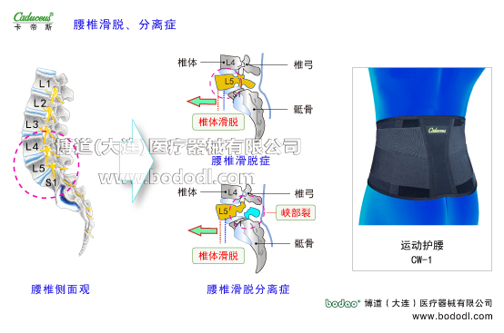 腰椎部的運動損傷與防護