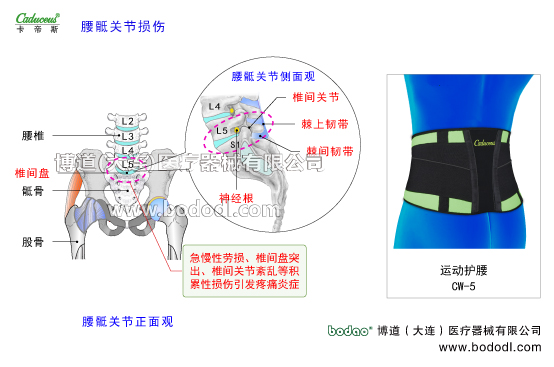腰椎部的運動損傷與防護
