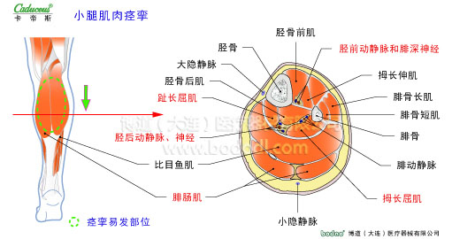 肌肉痙攣與加壓防護