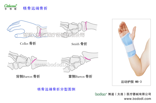 腕關(guān)節(jié)的運(yùn)動(dòng)損傷與防護(hù)