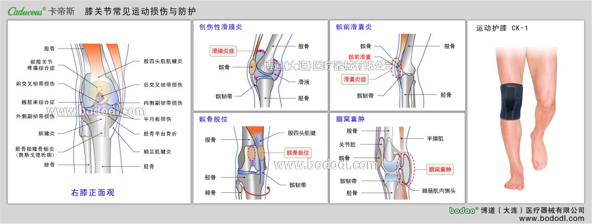 膝の主なスポーツ損傷