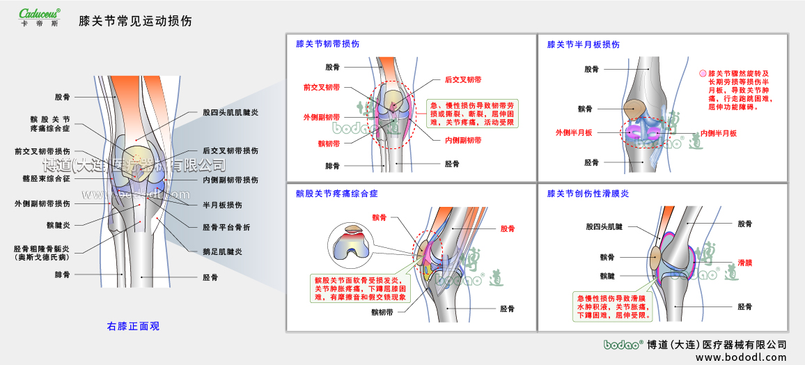 膝關(guān)節(jié)運動損傷的類型與癥狀