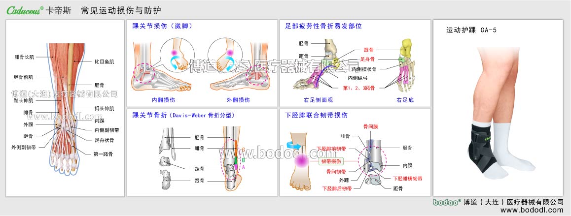 MAJOR SPORTS INJURY OF ANKLE JOINT
