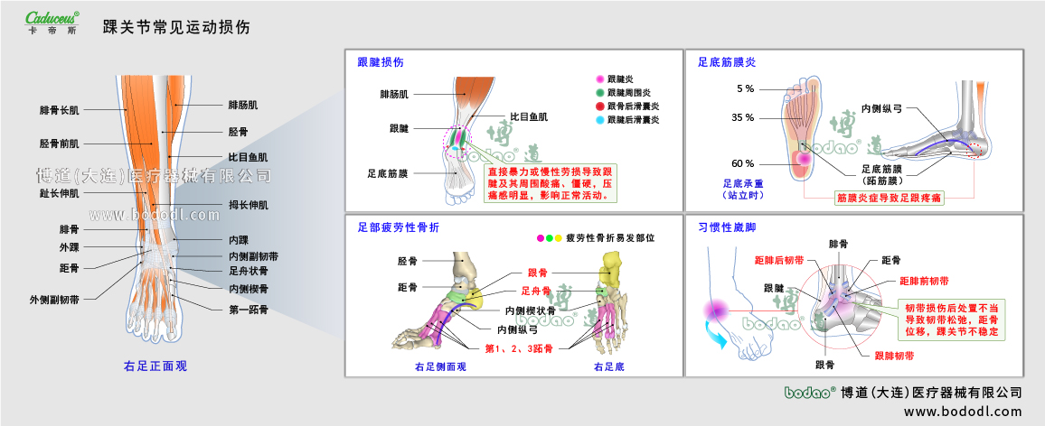 踝關(guān)節(jié)運(yùn)動(dòng)損傷的類型與癥狀