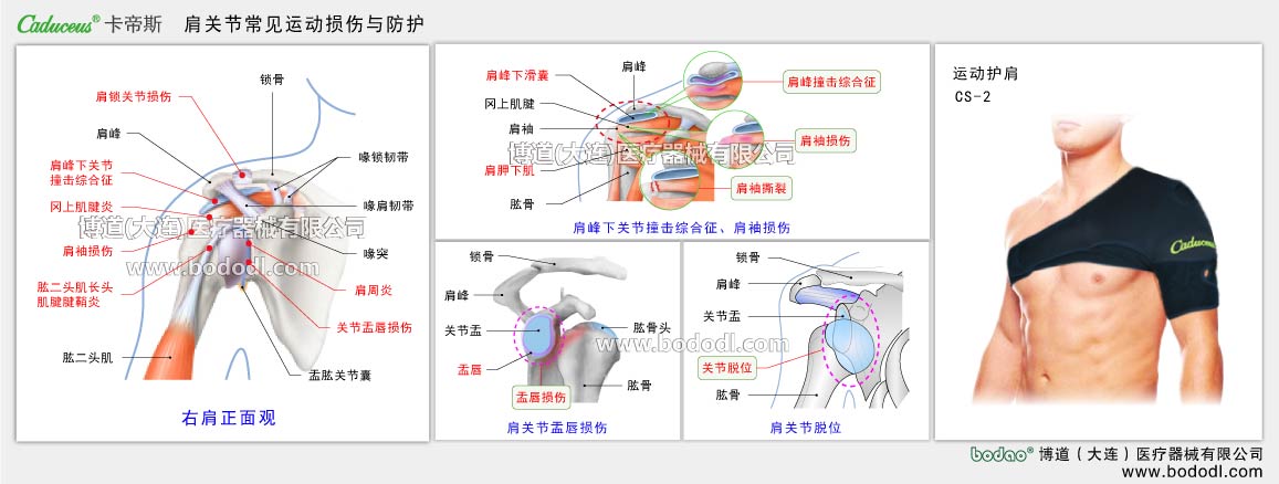 COMMON SPORTS INJURIES OF SHOULDER JOINT 