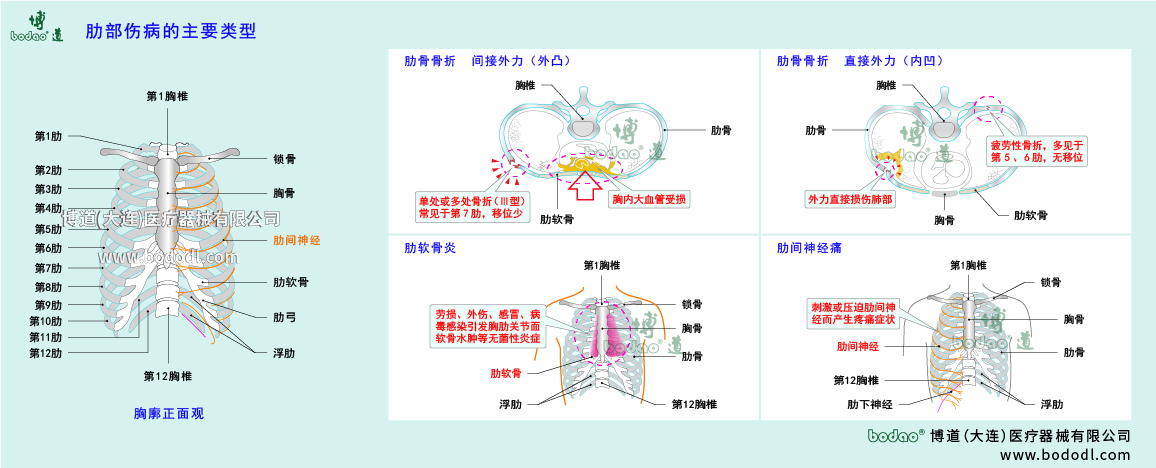 肋部傷病的類(lèi)型與癥狀