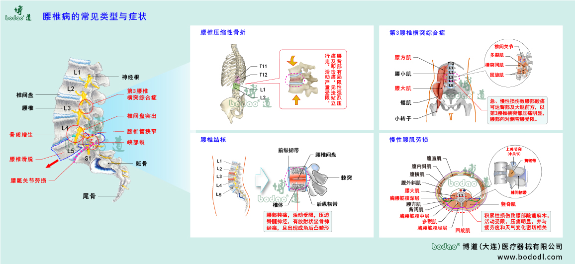 腰椎病的類型與癥狀