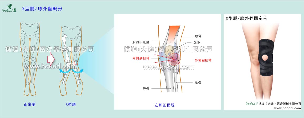 COMMON DISEASES OF KNEE JOINT 