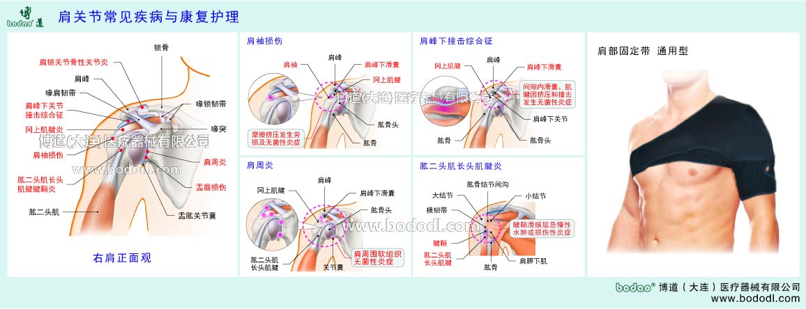 肩関節(jié)の主な疾患