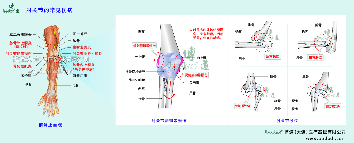 肘關(guān)節(jié)傷病的類型與癥狀
