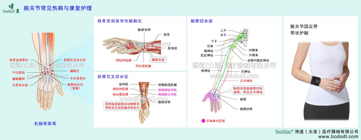 手関節(jié)の主な疾患